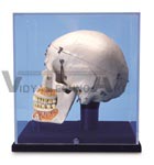 Deluxe Demonstration Skull, with display case